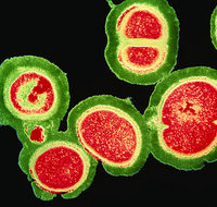 Mrsa220207_400x379_1_